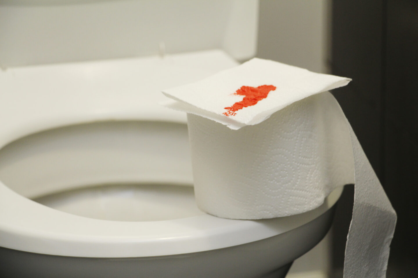 A roll of toilet paper with blood lies on the toilet, illustrating symptoms of rectal bleeding.