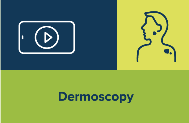 Dermoscopy